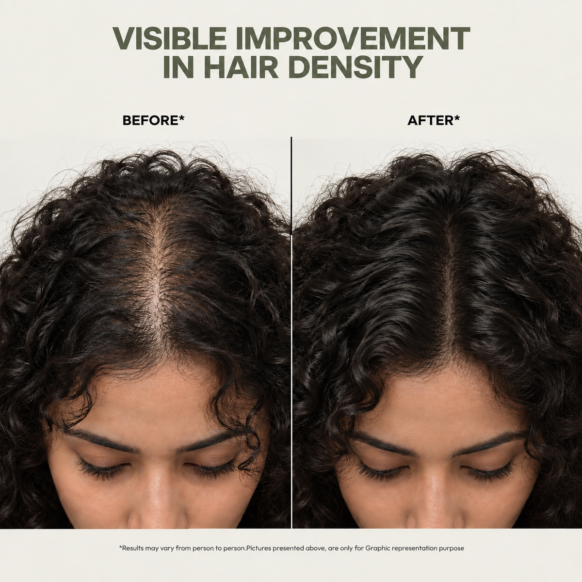 OILIQ Rosemary & Bhringraj Hair Oil | 100 ml